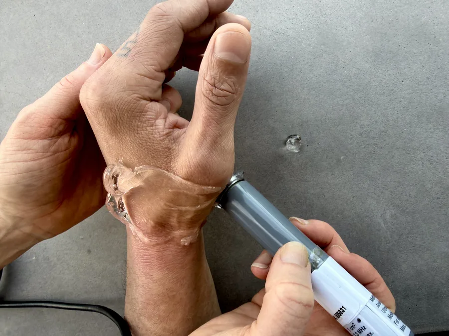 Therapeutic ultrasound modality — gel and wand on wrist